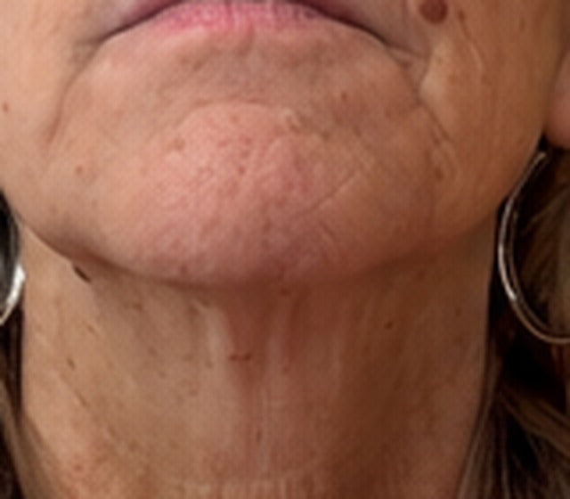 MOUTH after