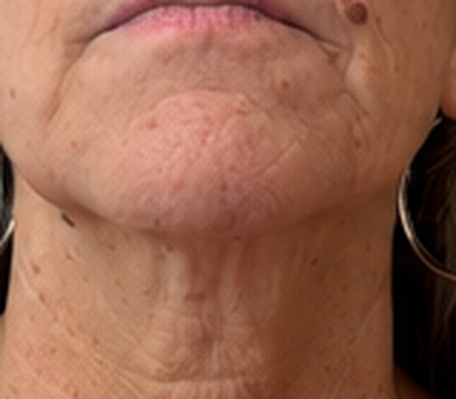 MOUTH before